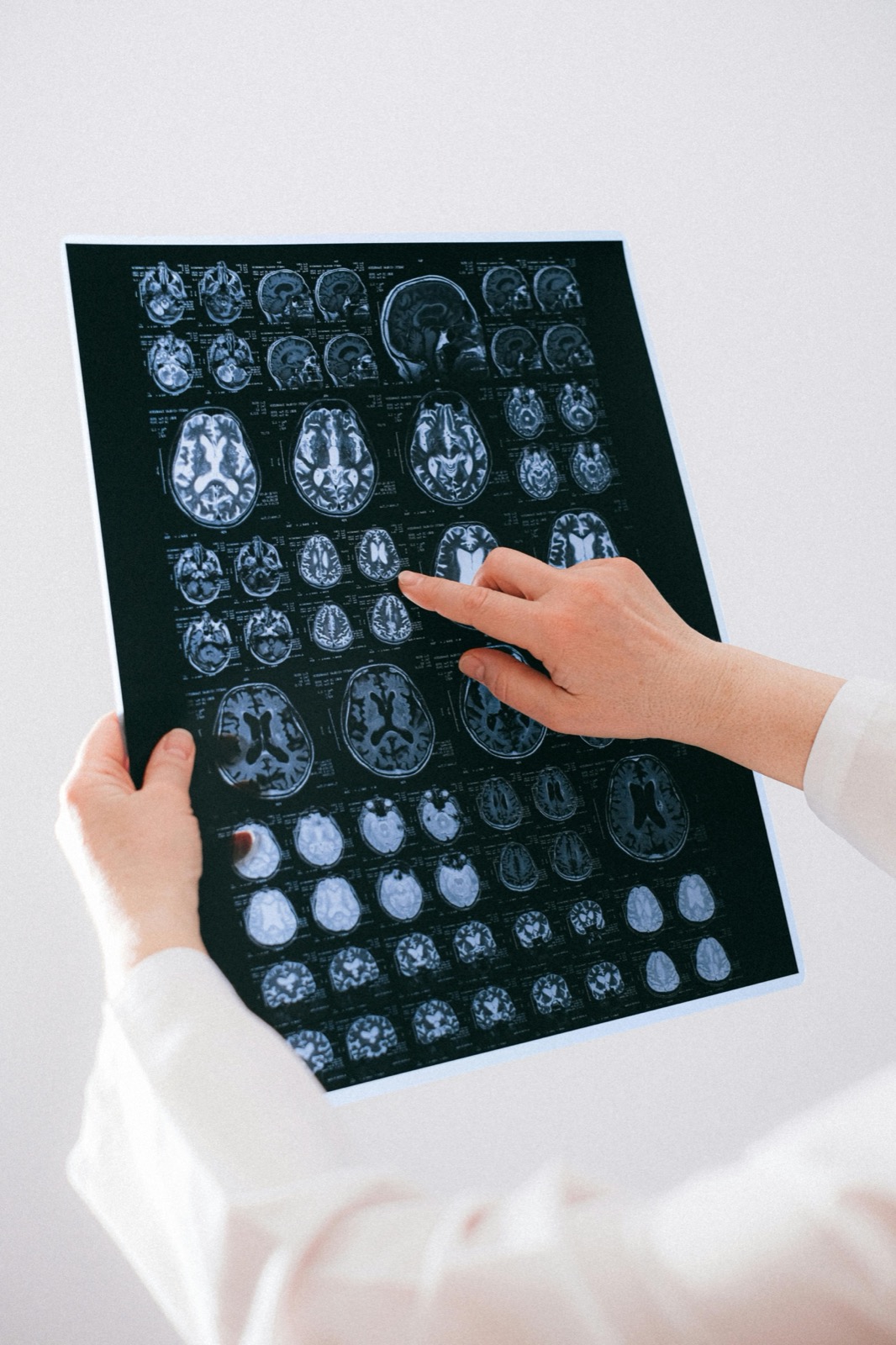 Medic examinând scanări cerebrale pentru diagnostic și tratament